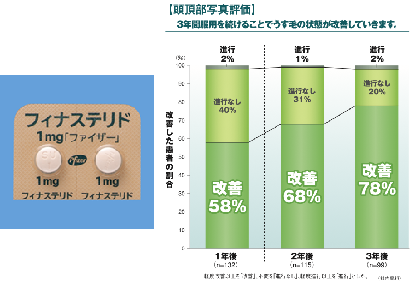 プロペシア 毛が生えてくる 増毛 AGA（男性型脱毛症） メディカルエステ 高岡美容皮膚科 白崎医院