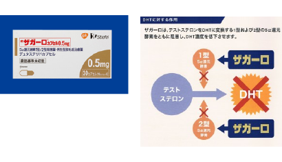 ザガーロ（新薬）毛が生えてくる 増毛  AGA（男性型脱毛症） メディカルエステ 高岡美容皮膚科 白崎医院