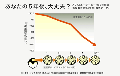 AGA（男性型脱毛症） 白崎医院 増毛 毛が生えてくる 増毛