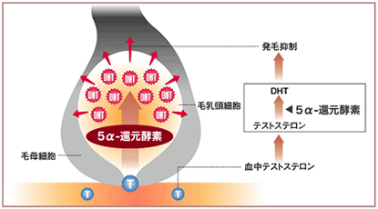 AGA（男性型脱毛症） 白崎医院 増毛 毛が生えてくる