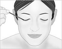 医療用まつげ育毛剤 メディカルエステ 高岡美容皮膚科 白崎医院