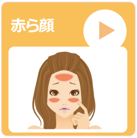 赤ら顔の治療 高岡市 美容皮膚科 メディカルエステ