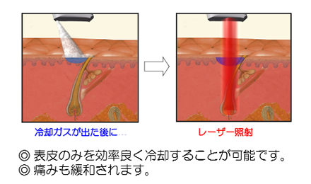 メディカルエステ 高岡美容皮膚科 白崎医院