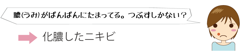 膿（うみ）がぱんぱんにたまってる。つぶすしかない？→化膿したニキビですね。つぶさないでください。 メディカルエステ 高岡美容皮膚科 白崎医院