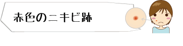 赤色のニキビ跡 メディカルエステ 高岡美容皮膚科 白崎医院