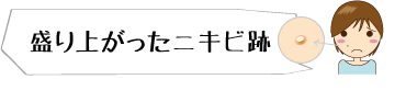盛り上がったニキビ跡 メディカルエステ 高岡美容皮膚科 白崎医院