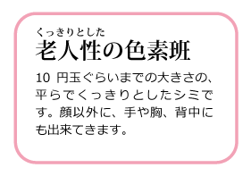 くっきりとした老人性の色素班 高岡美容皮膚科 白崎医院