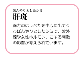 ぼんやりとしたシミ 肝斑