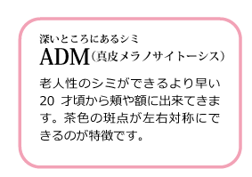 深いところにあるシミ ADM（真皮メラノサイトーシス） 高岡美容皮膚科 白崎医院
